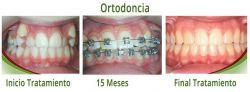 Ortodoncia 01